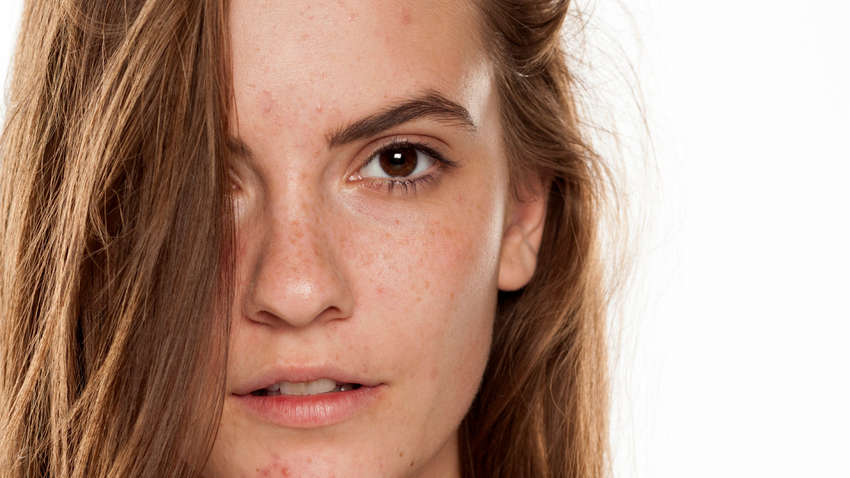О каких проблемах наш организм «кричит» через кожу О каких проблемах наш организм «кричит» через кожу