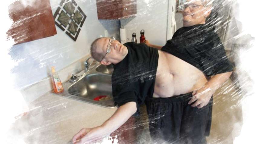 У США померли брати Геліон - найстаріші сіамські близнюки у світі 