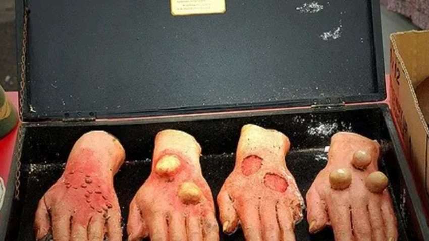 Окупанти почали застосовувати проти ЗСУ нову хімічну зброю зі страшним ефектом 