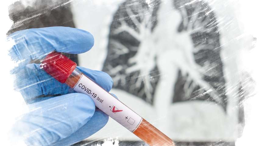 Коронавирус в Украине: сколько человек заболело за сутки 