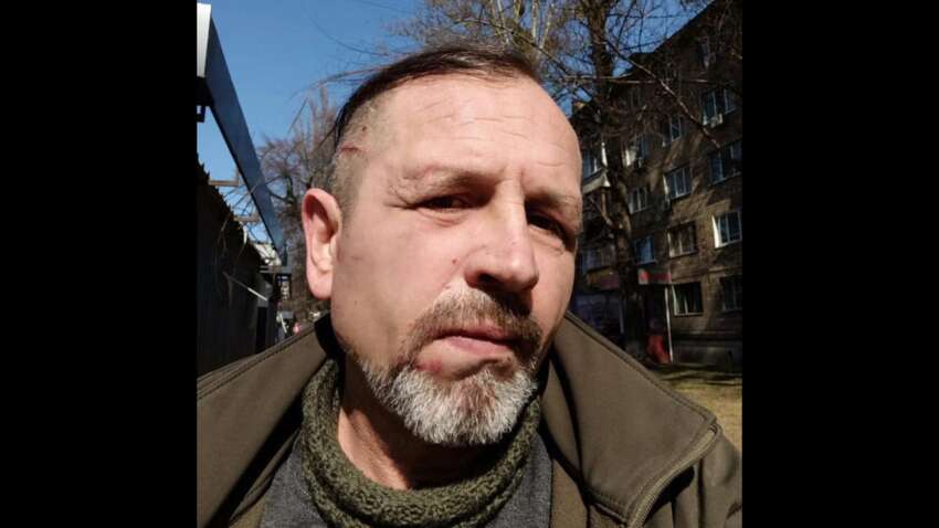 Жестокий конфликт: ТЦК избили ветерана войны Жестокий конфликт: ТЦК избили ветерана войны