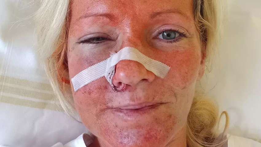 У Чехії чоловік сильно побив двох жінок, коли дізнався, що вони українки