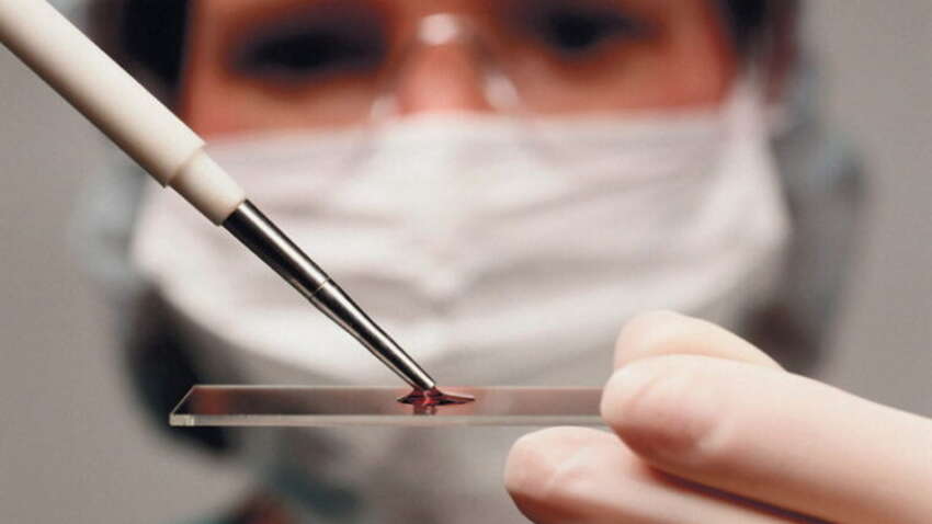 Зимняя опасность: как густая кровь угрожает вашему здоровью и что делать прямо сейчас Зимняя опасность: как густая кровь угрожает вашему здоровью и что делать прямо сейчас