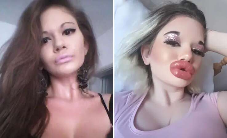 Жінка з найбільшими губами у світі хоче бути схожа на ляльку (ФОТО) Жінка з найбільшими губами у світі хоче бути схожа на ляльку (ФОТО)