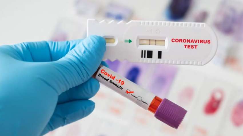 В Україні з’являться безкоштовні тести на коронавірус, але не скрізь