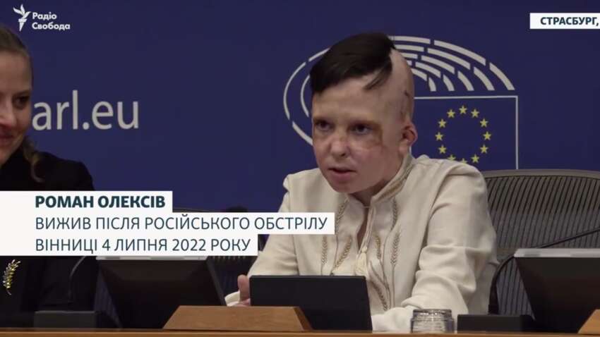 Не смогла сдержать слез: переводчица расплакалась во время выступления 11-летнего Романа, пережившего ракетный удар по Виннице Не смогла сдержать слез: переводчица расплакалась во время выступления 11-летнего Романа, пережившего ракетный удар по Виннице