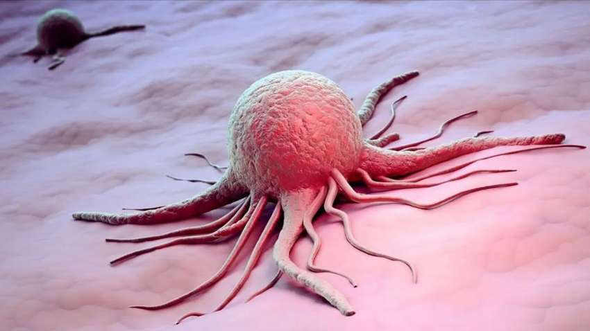 Доброкачественная опухоль: чем опасно новообразование  Доброкачественная опухоль: чем опасно новообразование