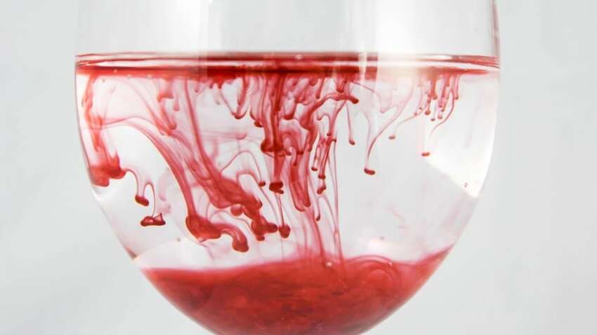 Сонник: до чого сниться кров