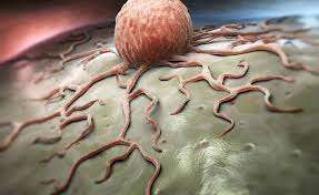 Коронавирус может запускать рак в организме: шокирующее исследование