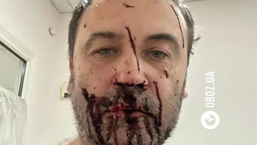 Путин добрался до российского оппозиционера: в его дом под Киевом прилетел дрон 