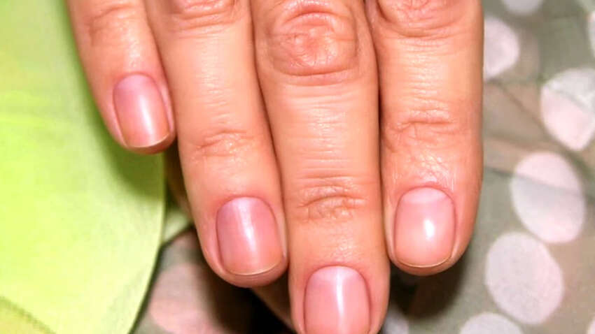 Белые пятна на ногтях не так безопасны, как считается: какие болезни можно определить по состоянию ногтей Белые пятна на ногтях не так безопасны, как считается: какие болезни можно определить по состоянию ногтей