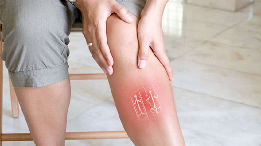 Які продукти не можна їсти при варикозі та набряках Які продукти не можна їсти при варикозі та набряках