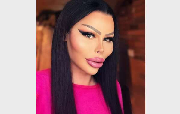 Чоловік 16 років поспіль робить пластику, вводить філери і ботокс: як він виглядає