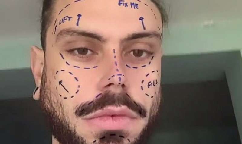 Instagram заборонив фільтри з пластичною хірургією