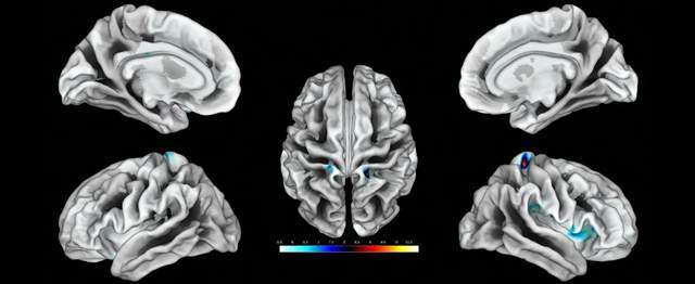 Вчені виявили в мозку жінки область, що реагує на стимуляцію клітора Вчені виявили в мозку жінки область, що реагує на стимуляцію клітора