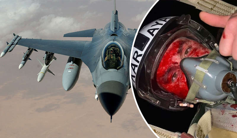 Пилот, показавший окровавленное лицо, стал Героем Украины