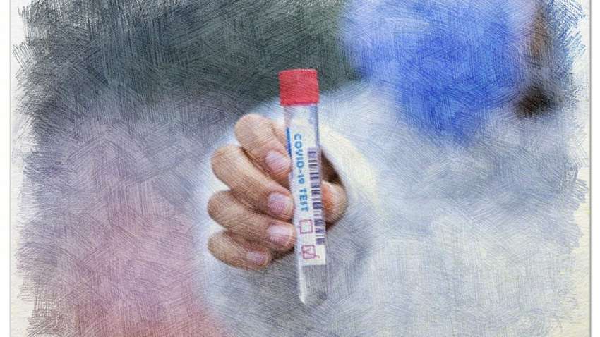 Коронавірус в Україні: з'явилися свіжі дані Коронавірус в Україні: з'явилися свіжі дані