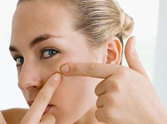 Медики рассказали, как расположение прыщей на лице связано с болезнями