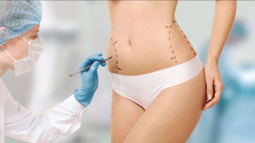 Женщина хотела увеличить ягодицы, но умерла на операционном столе Женщина хотела увеличить ягодицы, но умерла на операционном столе