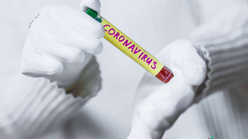 В Киеве появится возможность провериться на коронавирус дома