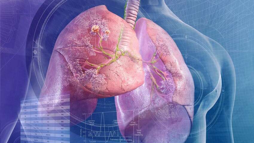 Об этом не догадываются: стало известно, где можно ежедневно заболеть раком легких Об этом не догадываются: стало известно, где можно ежедневно заболеть раком легких