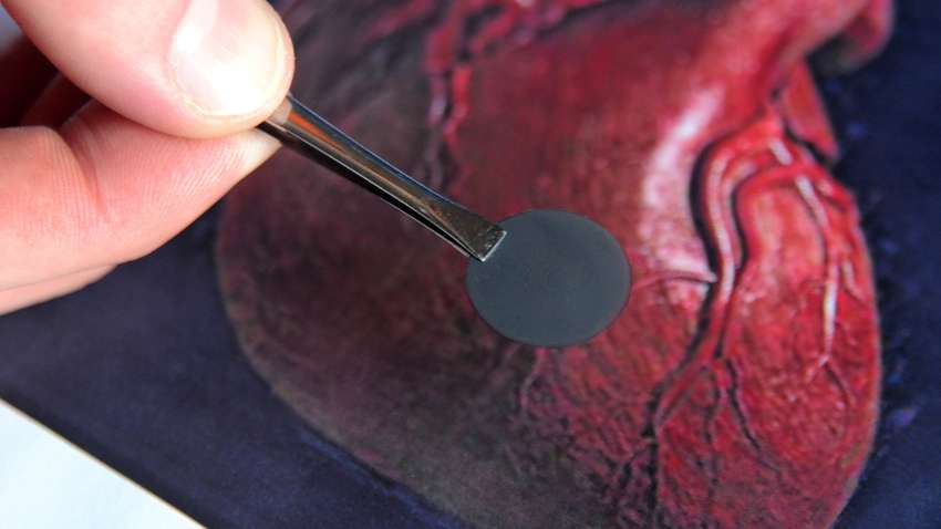 Стало відомо як запустити регенерацію серця 