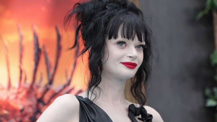 Известная актриса рассказала об ампутации второй ноги