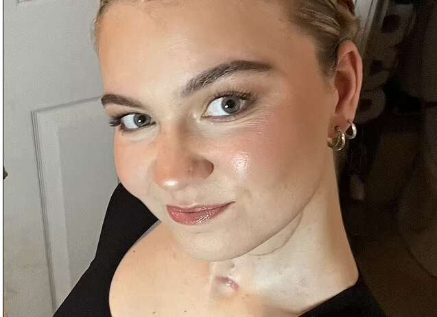 Девушка, которой вырезали язык, предупреждает каждого о страшной опасности Девушка, которой вырезали язык, предупреждает каждого о страшной опасности