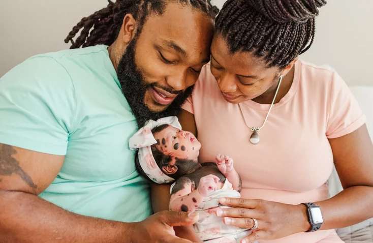 Батьки були налякані, коли побачили свою дитину: як сьогодні виглядає дівчинка-панда Батьки були налякані, коли побачили свою дитину: як сьогодні виглядає дівчинка-панда