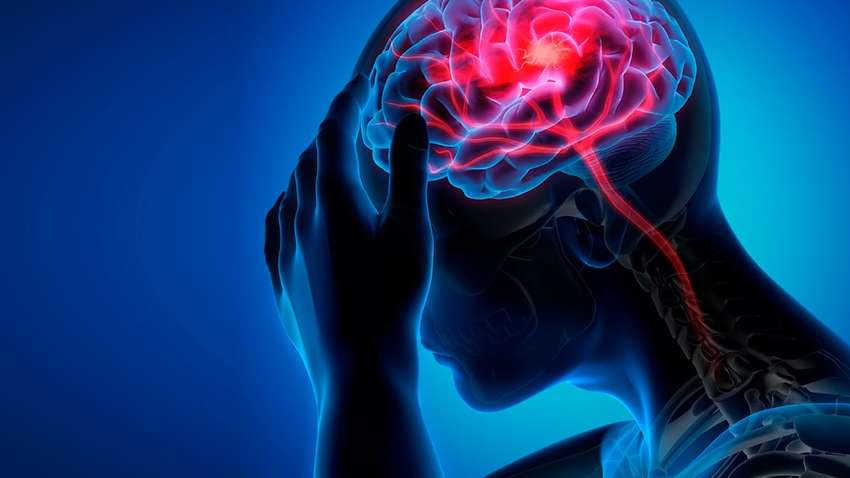 Названы 10 основных причин возникновения инсульта Названы 10 основных причин возникновения инсульта