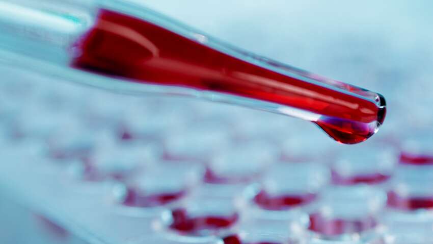 Преимущества и недостатки каждой группы крови: что они означают для здоровья