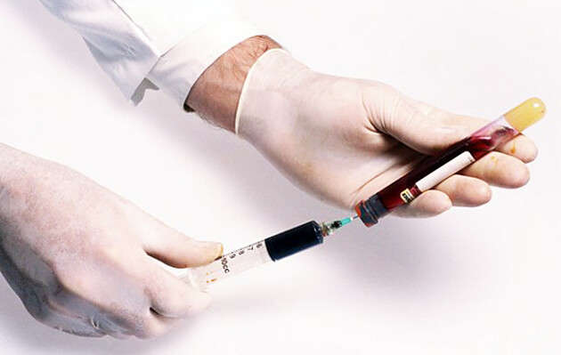 Названа країна, яка лідирує за темпами вакцинації від коронавірусу