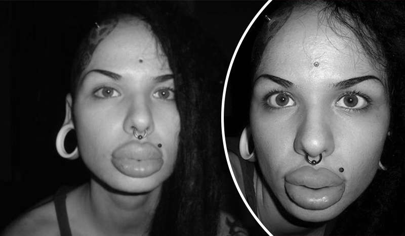 Умерла обладательница самых больших губ в мире: ей было 35 лет