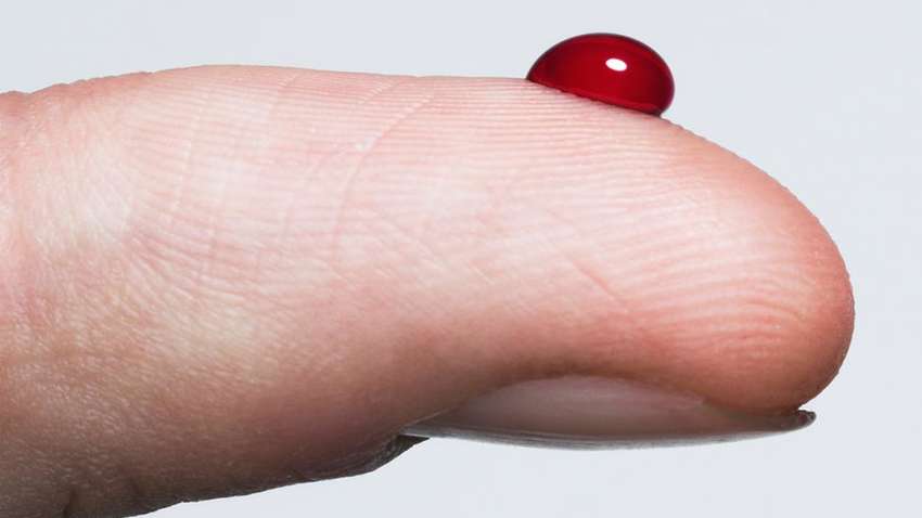 Запобігти інсульту чи серцевому нападу: тест на згортання крові можна буде зробити за допомогою смартфона Запобігти інсульту чи серцевому нападу: тест на згортання крові можна буде зробити за допомогою смартфона