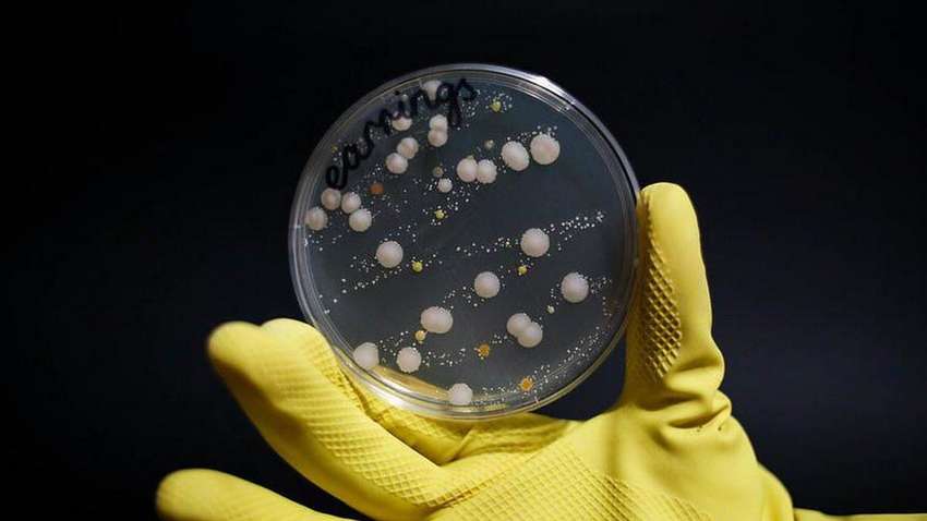 Ученые показали, сколько микробов живет на украшениях Ученые показали, сколько микробов живет на украшениях