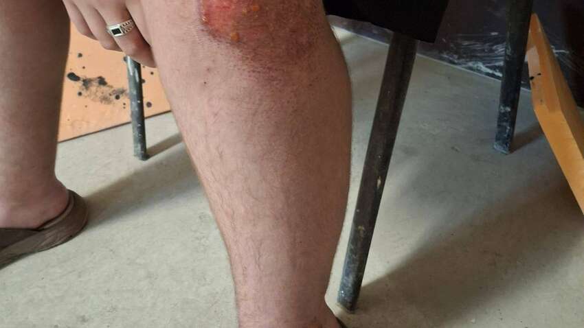 Напад на українця у Маріуполі