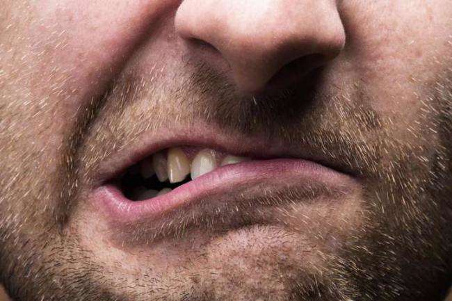 В Ровно женщина отсудила у бывшего мужа 5 тысяч грн, потому что он ее покусал В Ровно женщина отсудила у бывшего мужа 5 тысяч грн, потому что он ее покусал