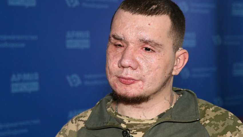 Воїну, який втратив зір під час виконання бойового завдання, просять надати звання Герой України Воїну, який втратив зір під час виконання бойового завдання, просять надати звання Герой України