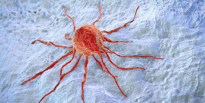 Можно ли вылечить рак народными методами? Мифы и реальность