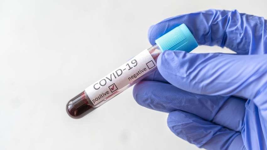 Лікар назвала п’ять найпоширеніших ускладнень після коронавірусу