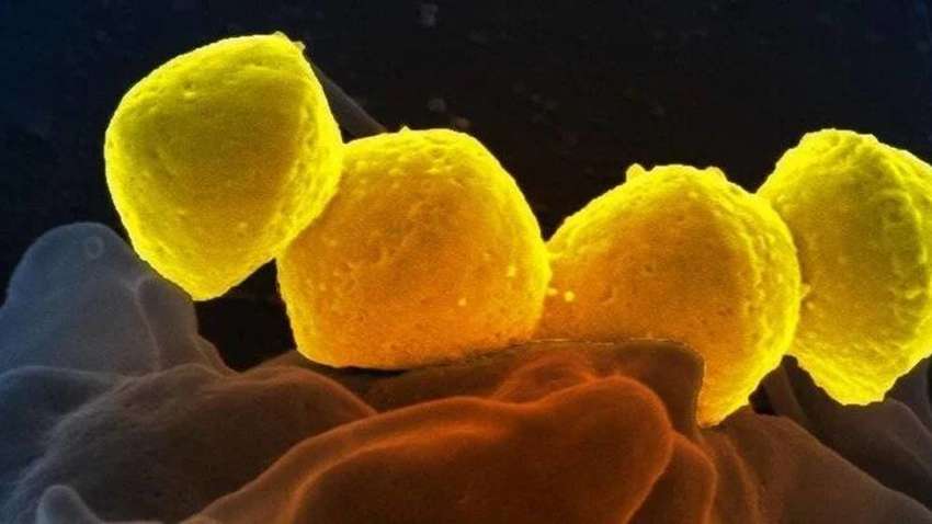 Ученые предупреждают: на коронавирусе все не закончится, человечество ожидает новая эпидемия