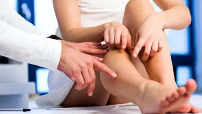 Симптом смертельного раку проявляється на нігтях на ногах: зверніть на це увагу