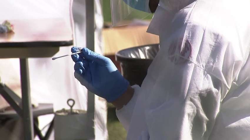 Искусственный интеллект обнаружит Covid-19 у бессимптомных больных