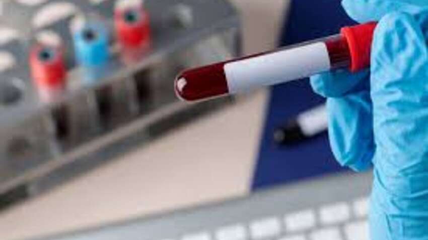 Минус для здоровья: какая группа крови самая опасная - исследование Гарварда Минус для здоровья: какая группа крови самая опасная - исследование Гарварда