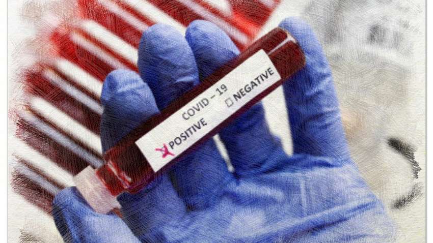 Коронавирус в Украине: за сутки подтвердились еще 914 случаев заражения