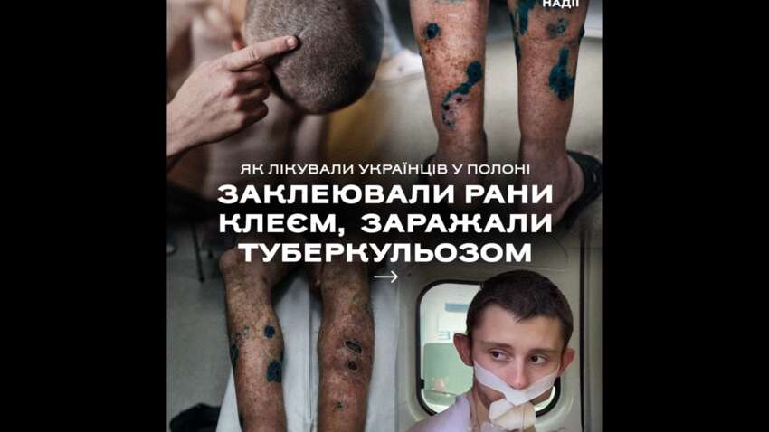 «Медицина» в плену: голову заклеили