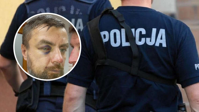 У Польщі поліція побила українців після конфлікту з поляками (ФОТО) У Польщі поліція побила українців після конфлікту з поляками (ФОТО)