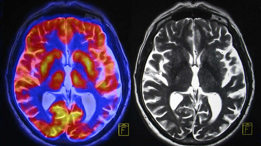 Ученые создали приложение для изучения мозга, оно работает по принципу Tinder