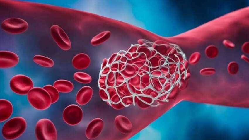 Этот обычный овощ поможет защититься от тромбоза и избежать рака: о чем идет речь. 