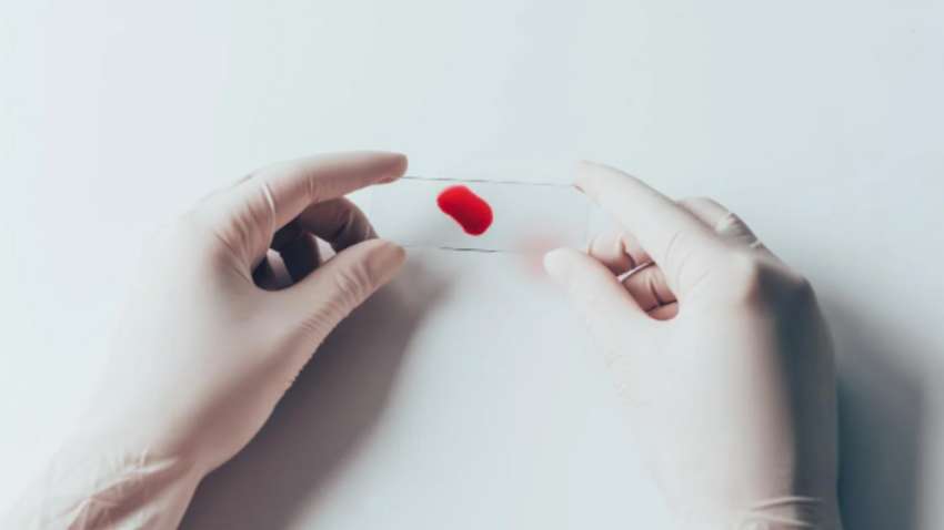 Медики рассказали, какая группа крови считается самой "уязвимой"